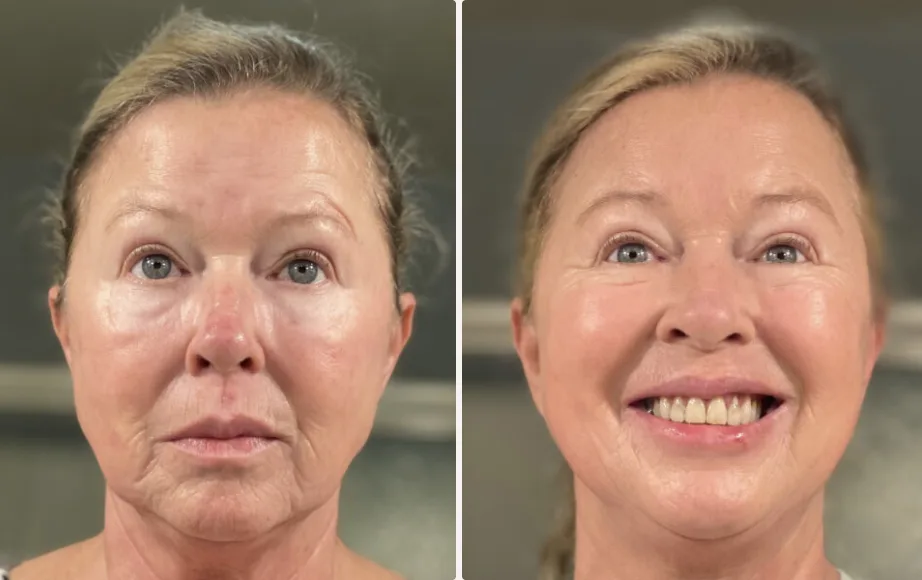 ghk-cu cream before and after Skin Renewal Cream – Healthy Living Clinic